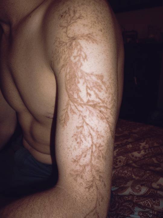 This is how a scar from a lightning strike looks like ? by Cool As Facts -  Pie Messenger